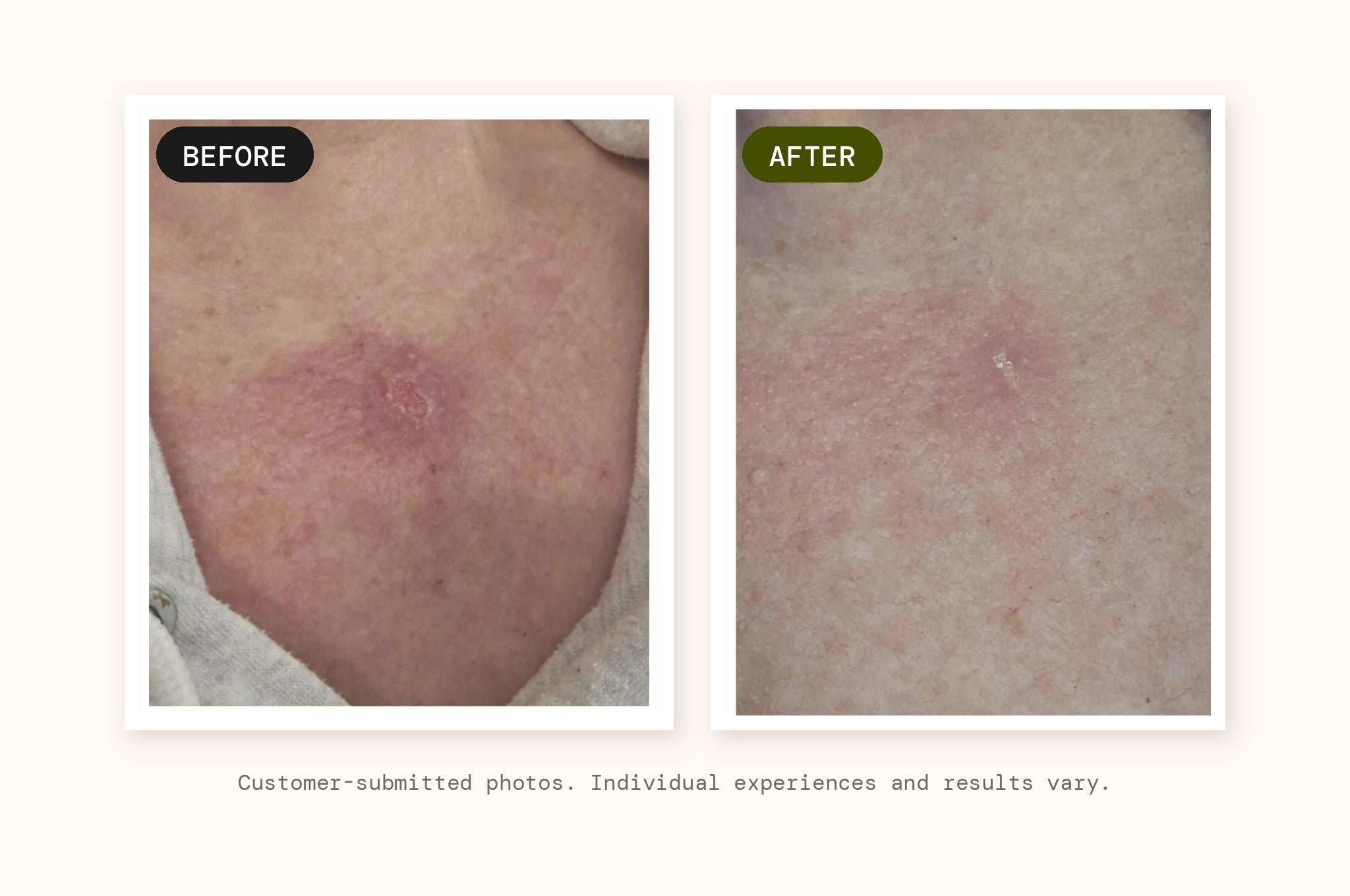 Customer-submitted before and after photographs of the application area