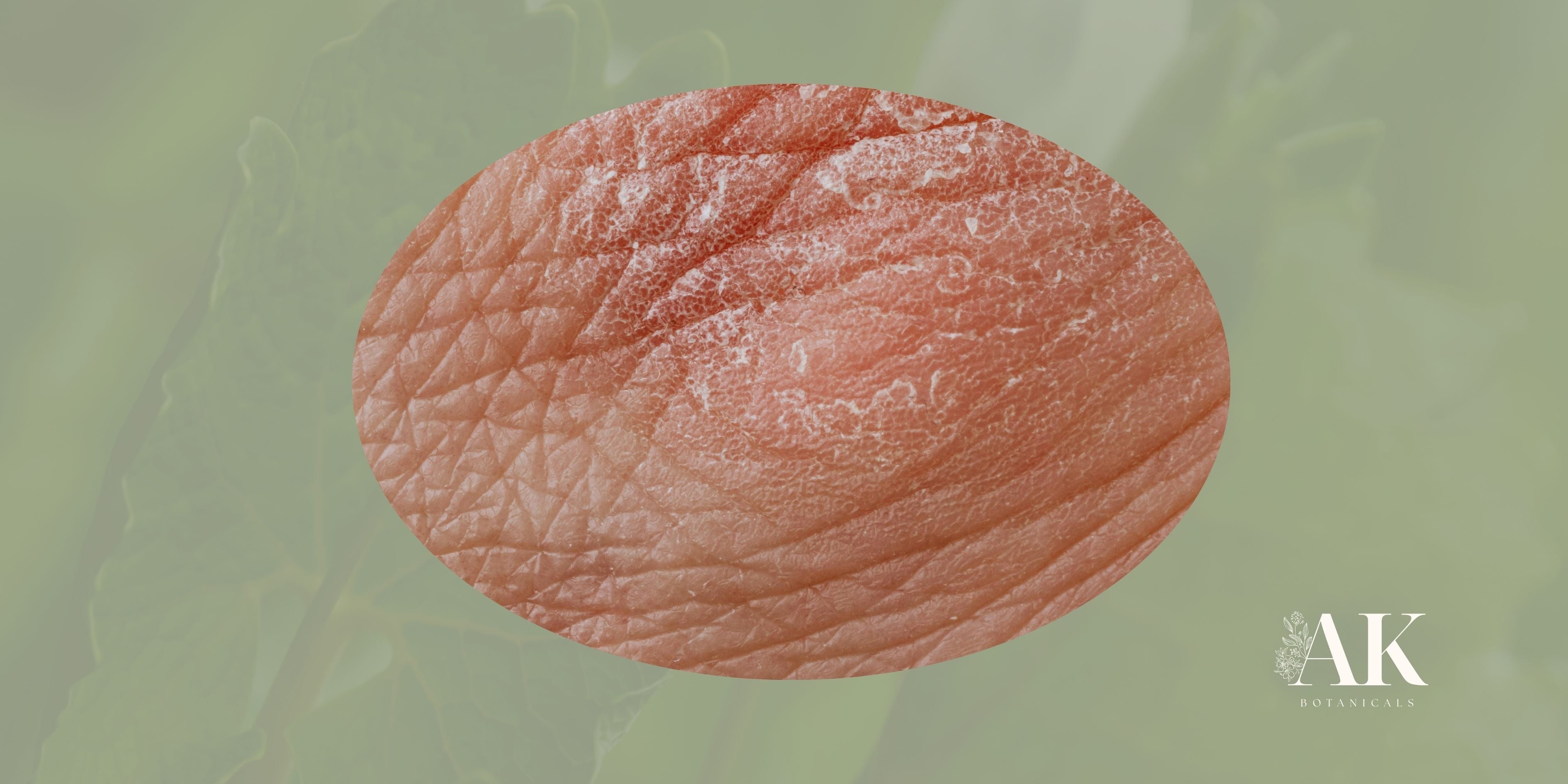 The shifting nature of sun-damaged skin and actinic cancer risk factors