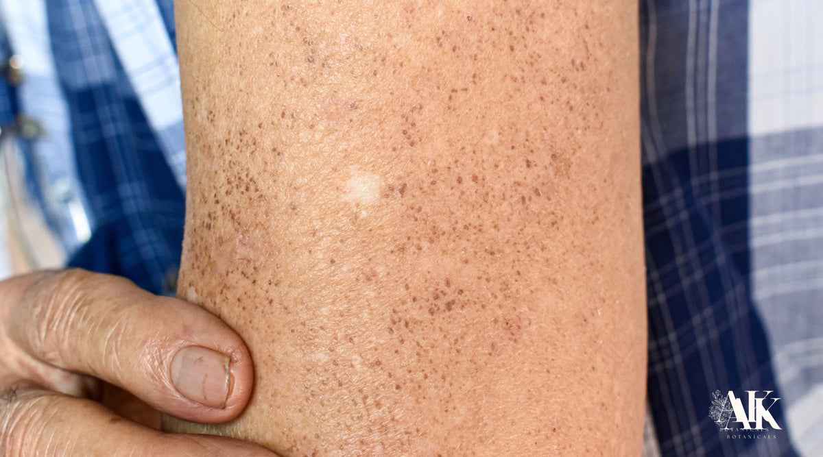 Which Over-the-Counter Products Are Best for Rough Skin Patches on the Arms?