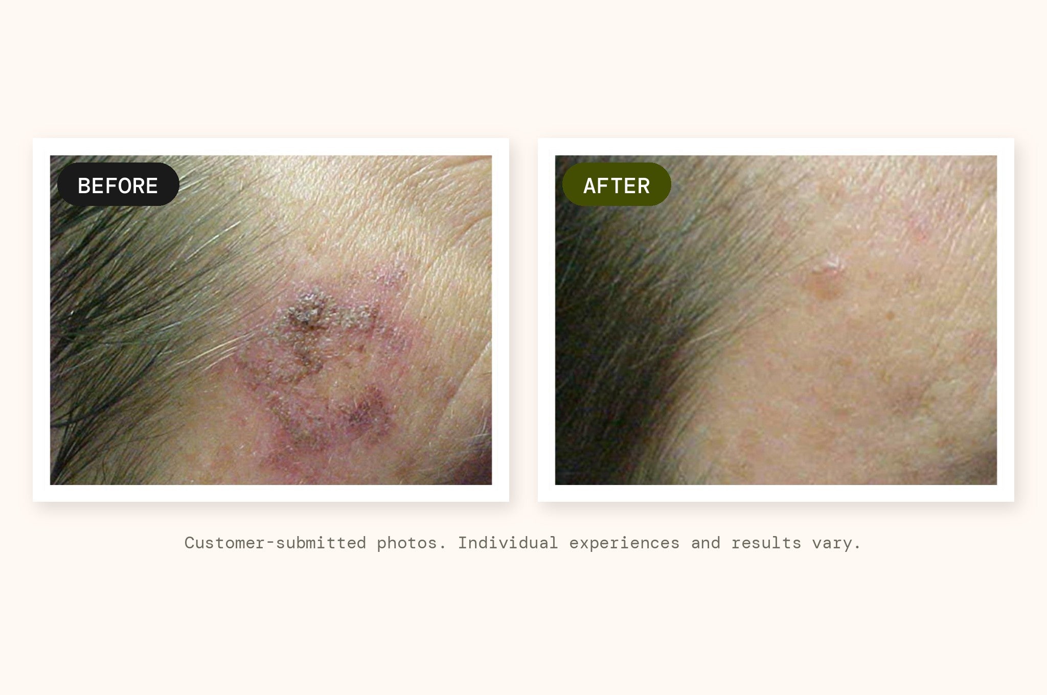 Customer-submitted before and after photographs of the application area
