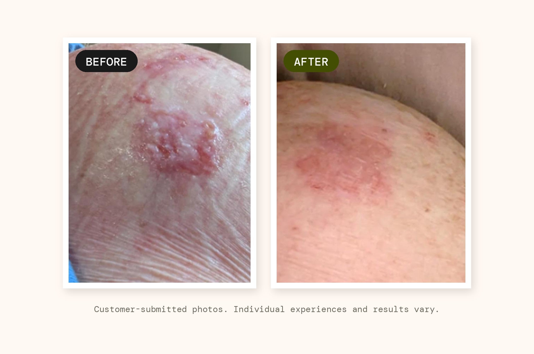 Customer-submitted before and after photographs of the application area