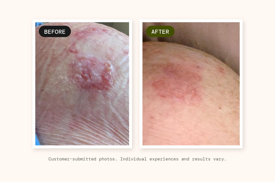 Customer-submitted before and after photograph